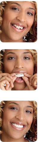 SNAP-ON SMILE | 2