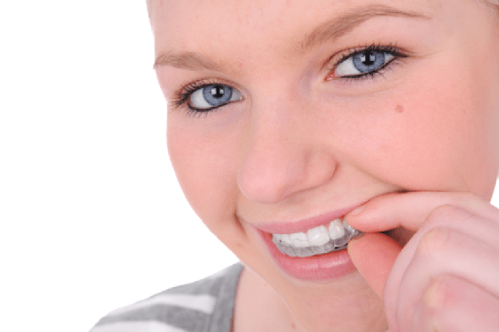 Dişleri telsiz düzeltme ortodontik
