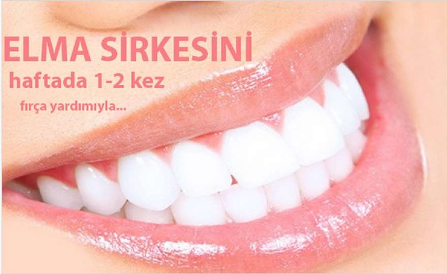 dis_beyazlatma