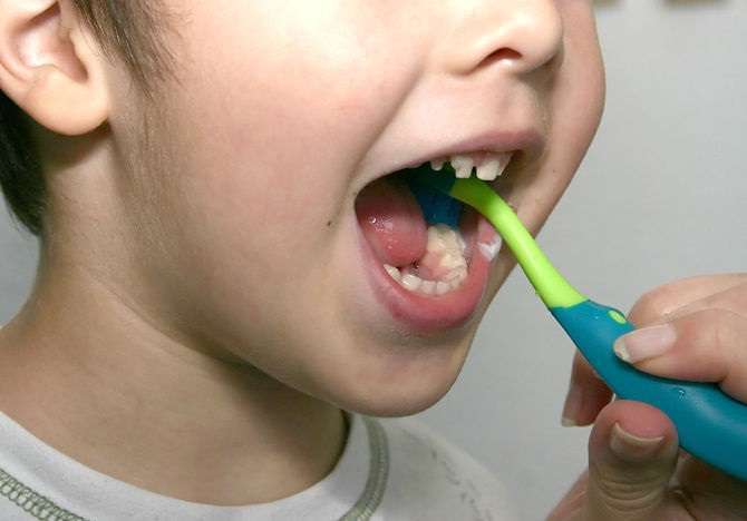 çocuğa diş fırçalama nasıl öğretilir