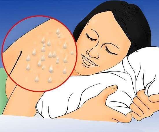aids_belirtileri (3)