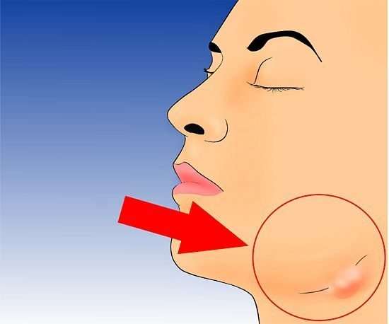 aids_belirtileri (5)