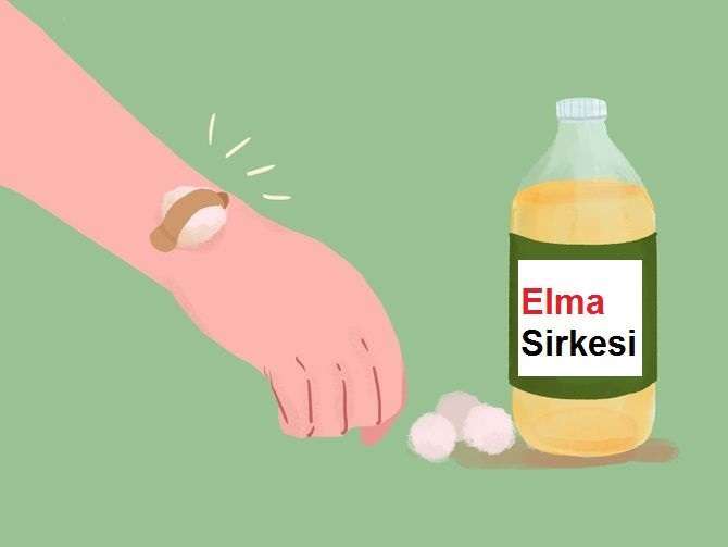 sivrisinek_ısırigina_ne_iyi_gelir (2)