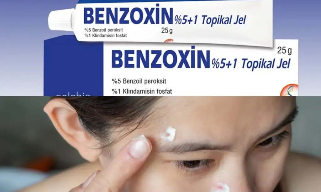 Benzoxin_ne_ise_yarar_sivilce_akne_tedavisi.webp