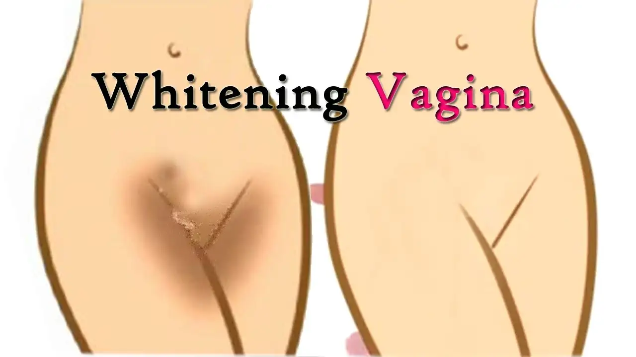 vajina_beyazlatma_yollari_yontemleri_genital_bolge.webp