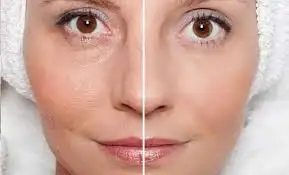gozenek_sikilastirici_maske.webp