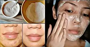 kirisiklik_gidermek_icin_dogal_maske_tarifleri.webp