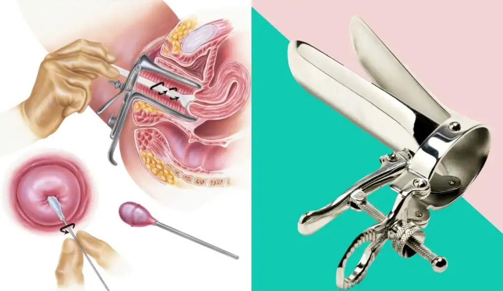 pap_smear_testi_nedir_nasil_yapilir.webp