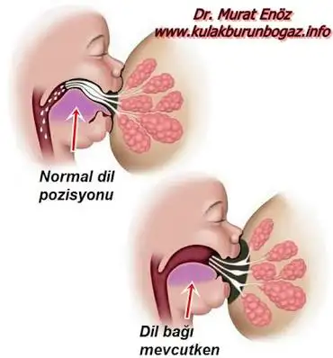 056B8C61-DF0B-46D1-AE5F-2A1332AC7170.webp