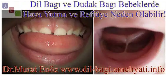 0742ECE7-90E8-42F2-806A-ACD4A0A7DAF9.webp