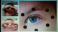 1.webp