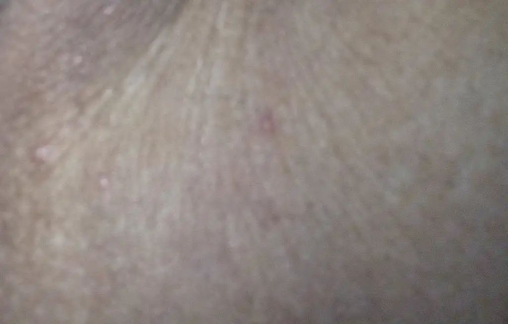 1000002155.webp