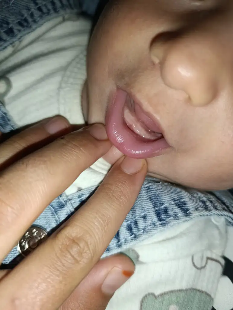 1000008296.webp
