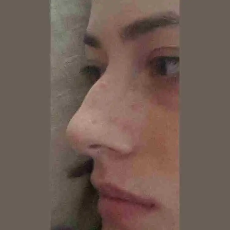 1419444132693.webp
