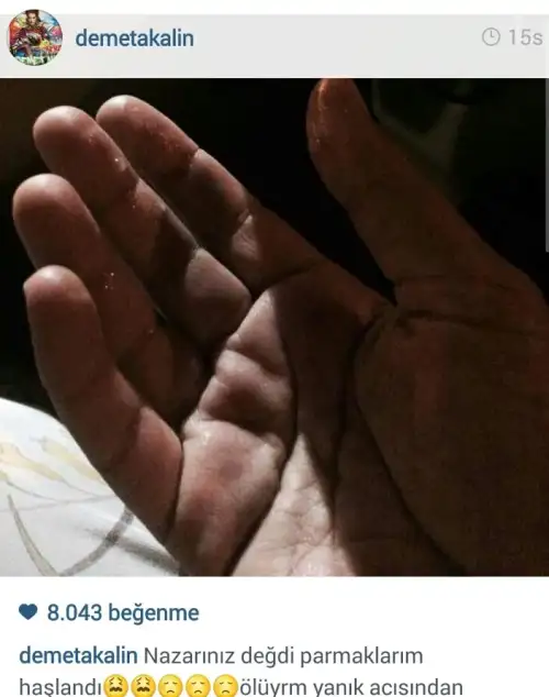 14gs7demet1.webp