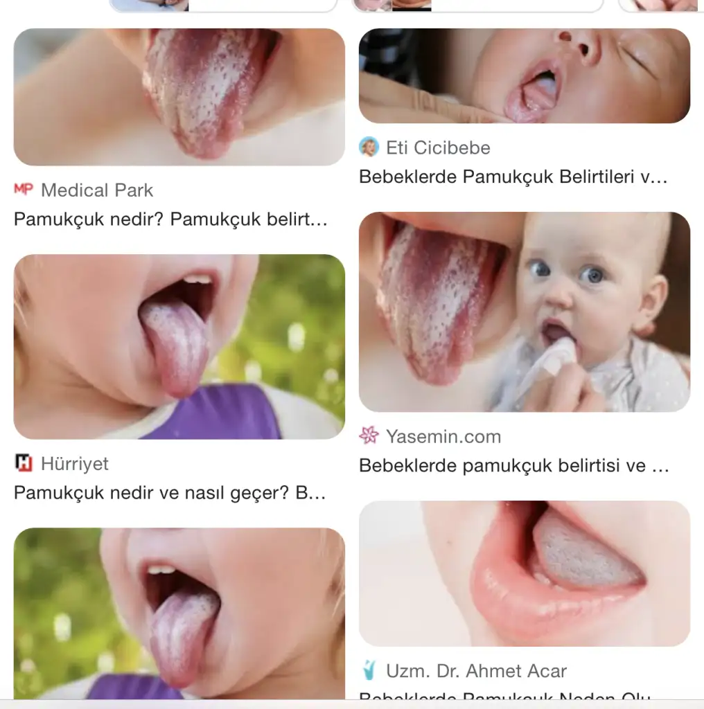 1687695690407.webp