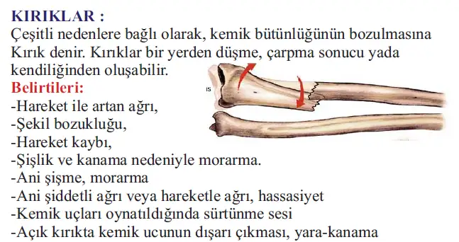 170.webp