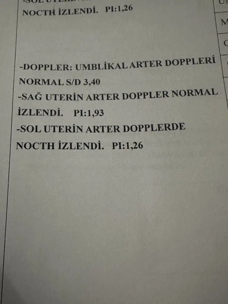 1prlSF.webp