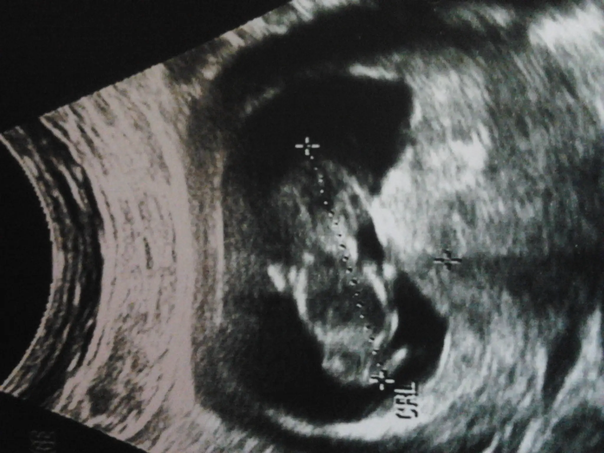 2014-10-01 20.42.18.webp