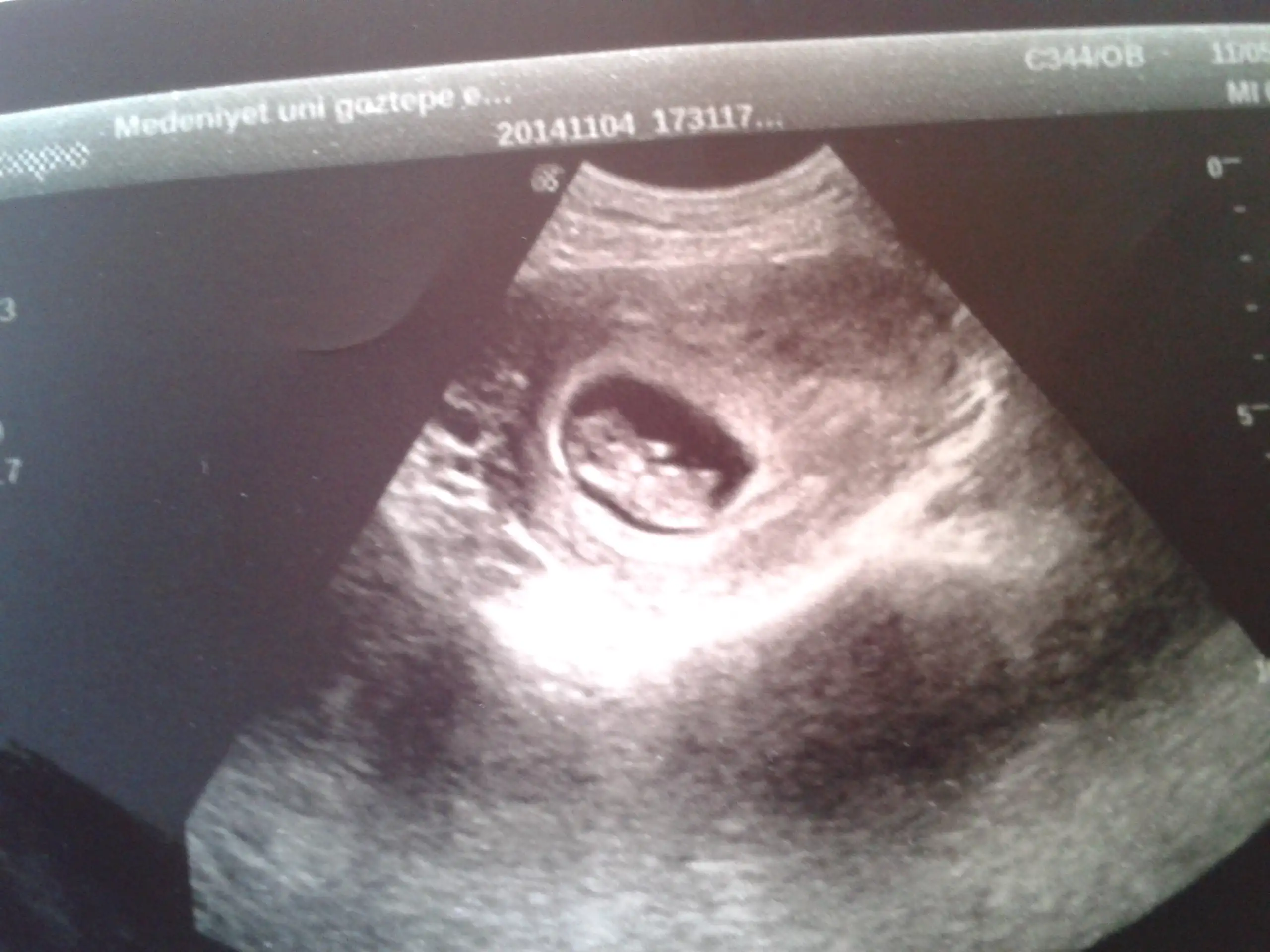 2014-11-06 07.18.23.webp