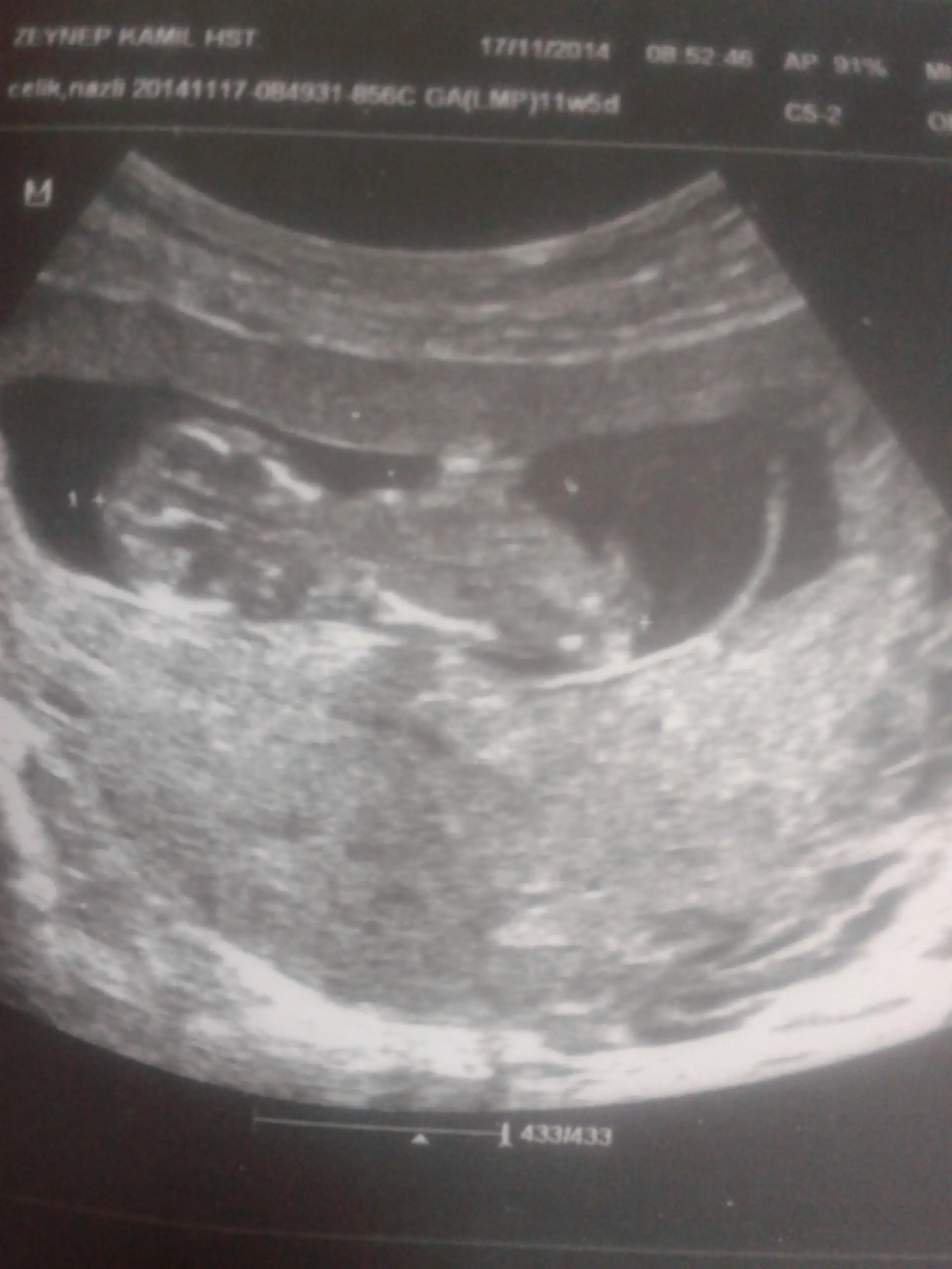 2014-11-17 09.22.44.webp