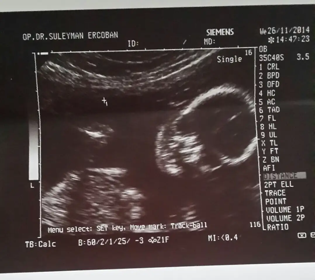 2014-11-26 15.57.15.webp