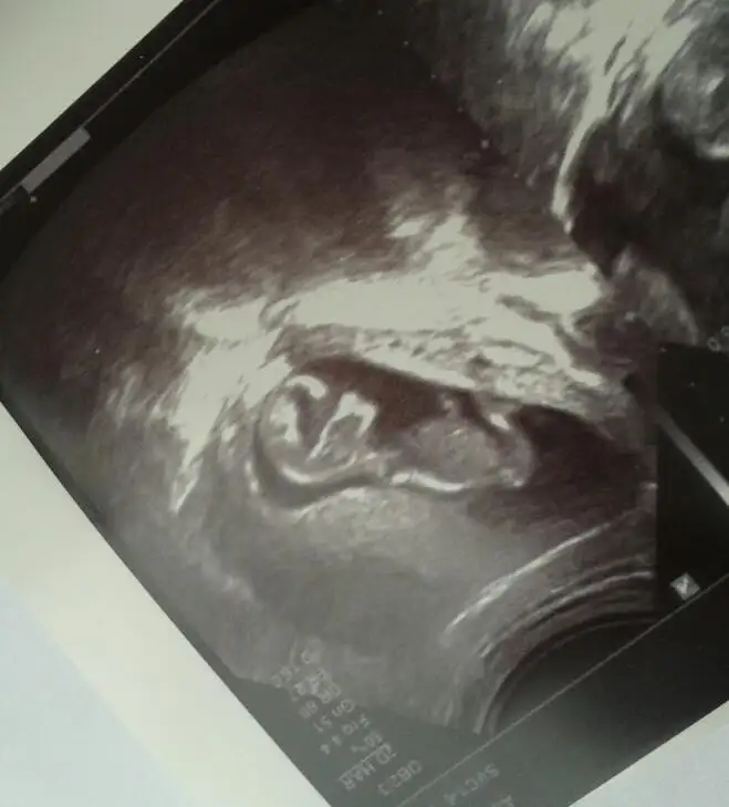 2014-12-01 11.31.04-1.webp