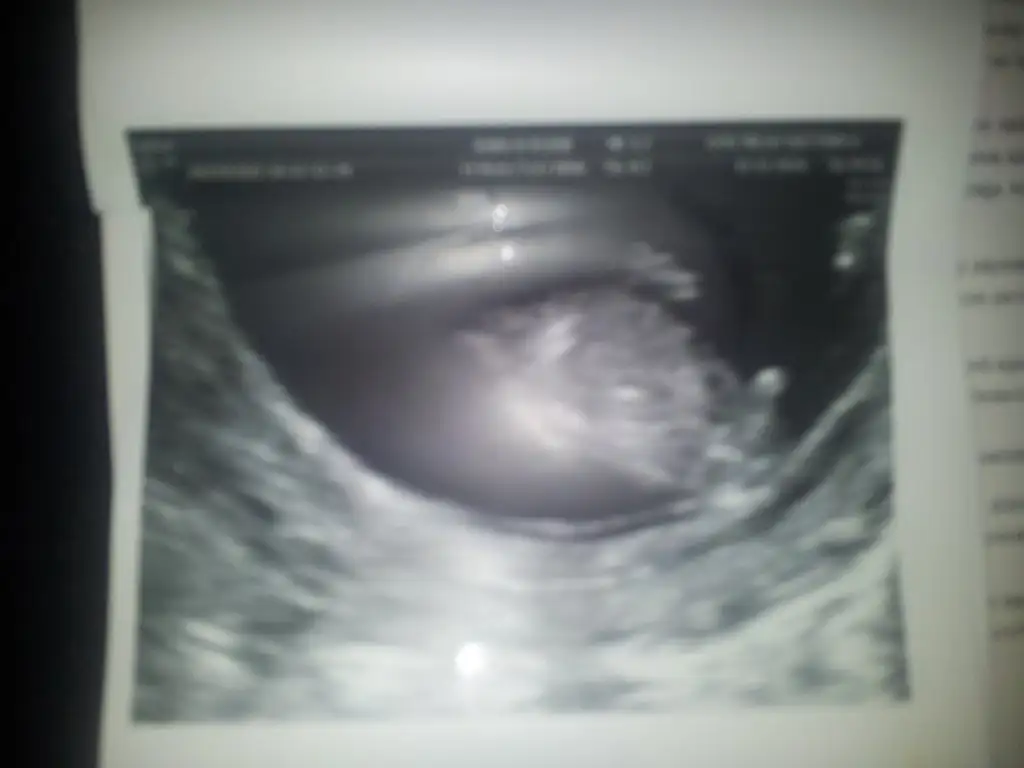 2014-12-14 19.55.22[1].webp