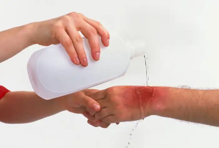 20141209_theoneshots_rip_burn.webp