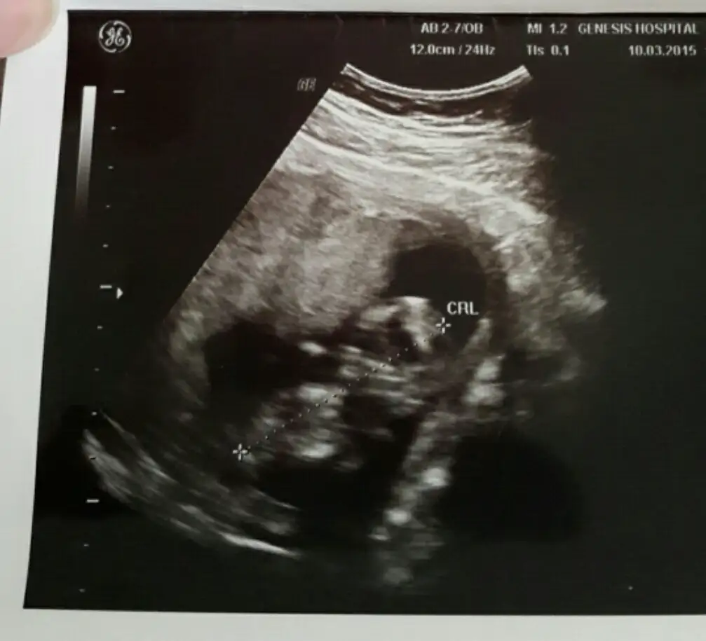 2015-03-14 16.10.38.webp