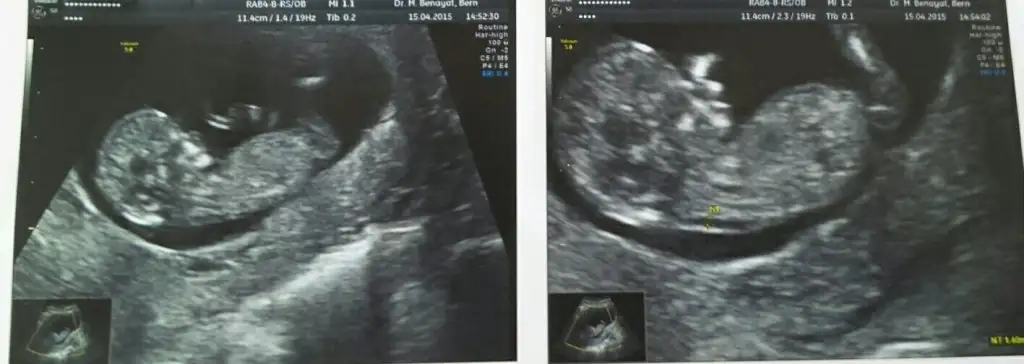 2015-04-17 17.52.11.webp