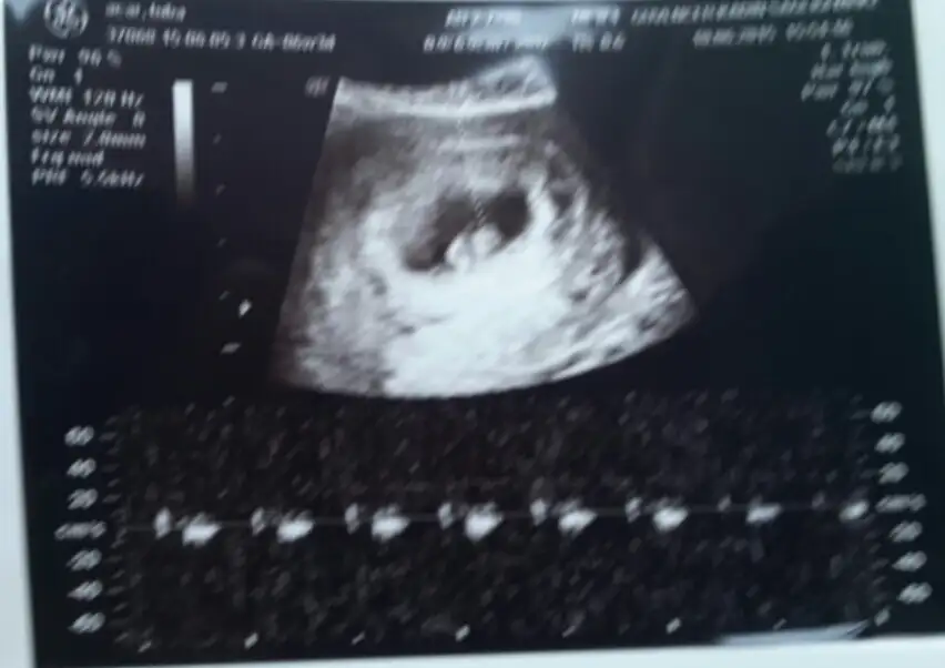 2015-06-10 17.02.21.webp