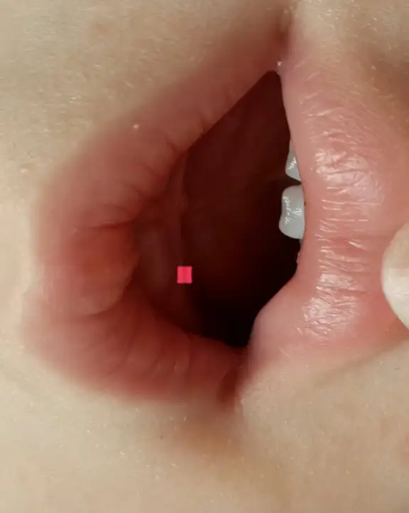 2015-06-28 10.45.58.webp