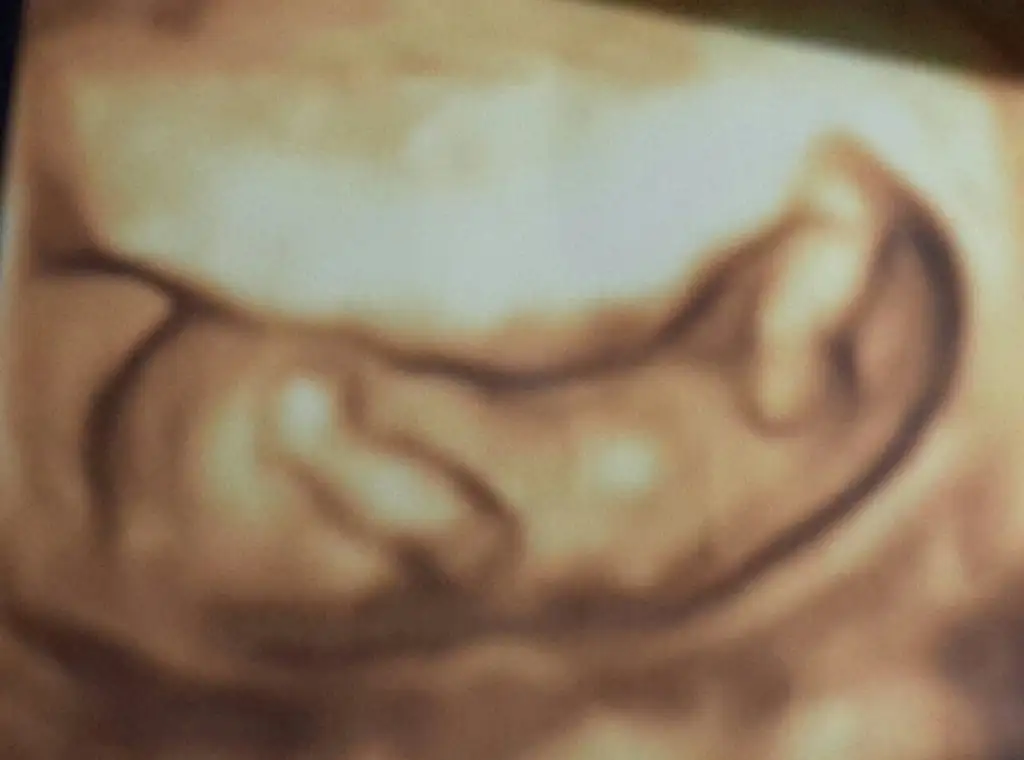 20150410_210419-1-1 (1).webp