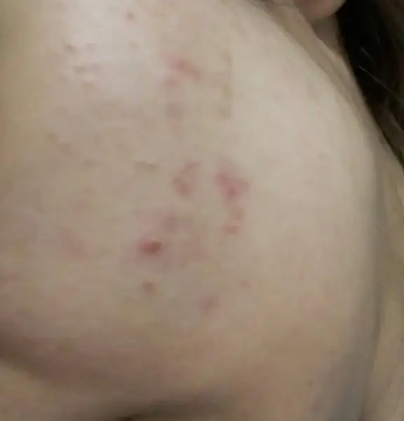 20161221_212210-1.webp