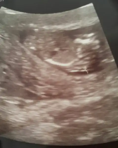 2017-05-29 19.48.07.webp