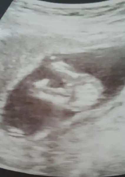 2017-06-03 09.58.39.webp