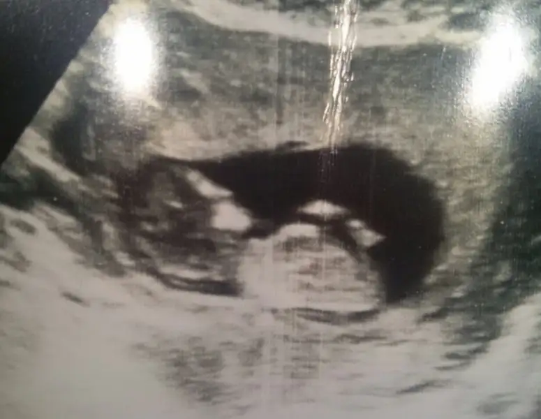 2017-07-27 14.16.39.webp