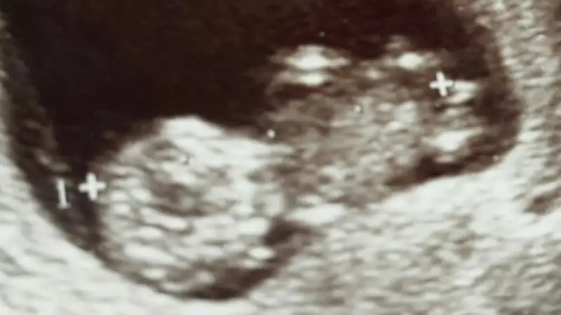 2017-07-27 19.45.03.webp