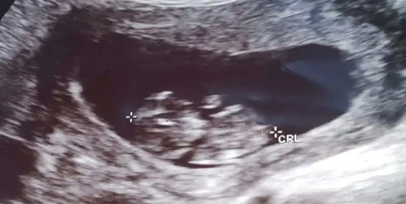 2017-08-07 15.55.37.webp