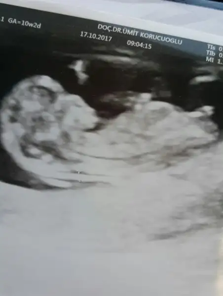 2017-10-17 12.34.16.webp