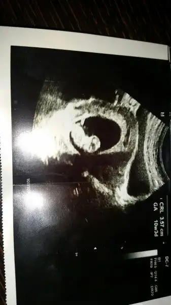 2017-11-01 12.46.18.webp