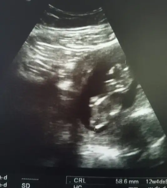 2017-11-02 16.10.34.webp