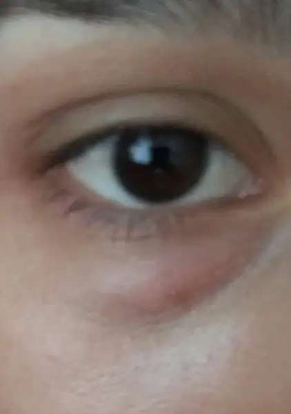20170718_120030.webp