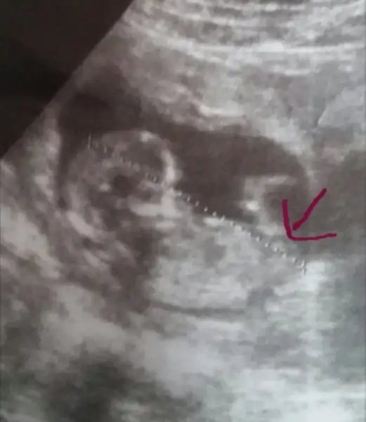 2018-01-11 18.00.27.webp