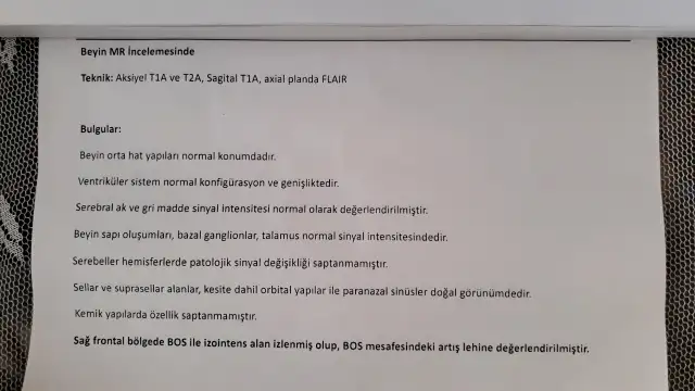 20180302_121140_20180302121237863.webp