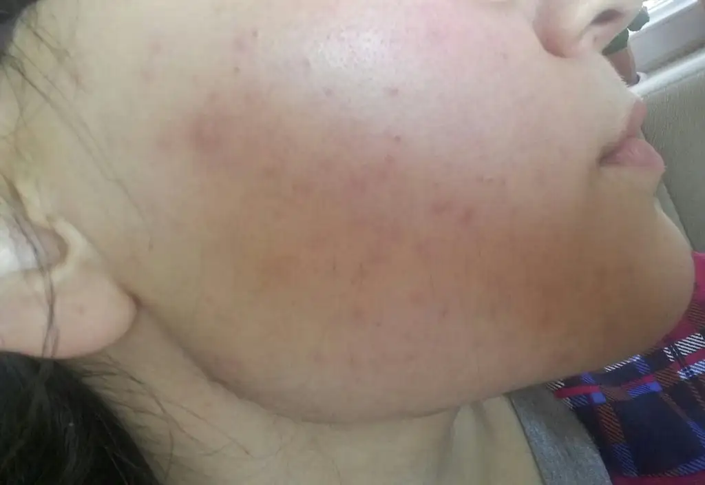 20190330_115351-1.webp