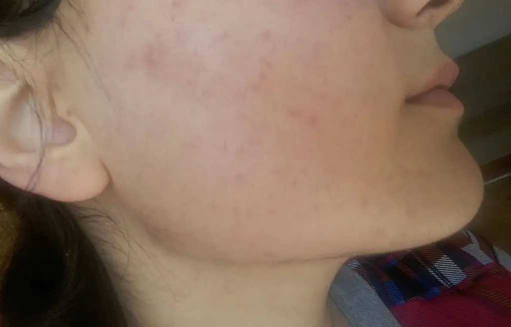 20190330_115433-1.webp