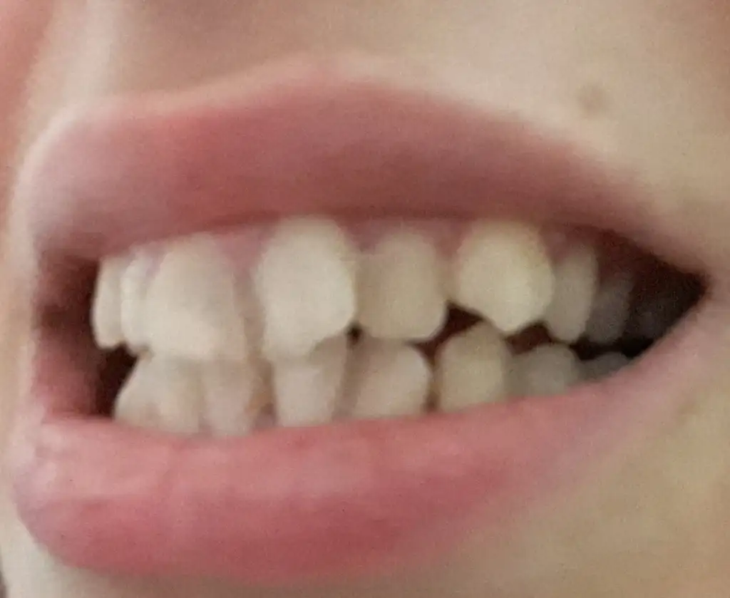 20201029_004309.webp