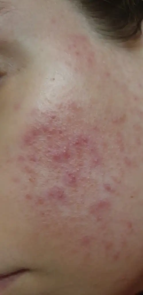 20220429_071401.webp